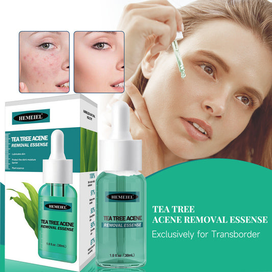 Tea Tree Removing Acne Liquid Female Desalination