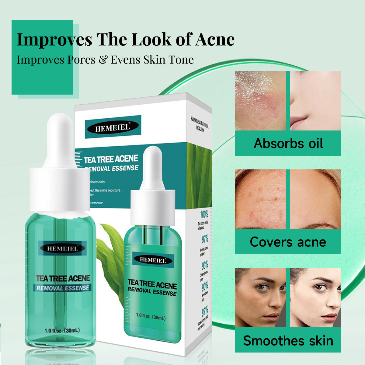 Tea Tree Removing Acne Liquid Female Desalination